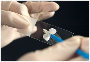 Papa-test na humani papiloma virus infekcije